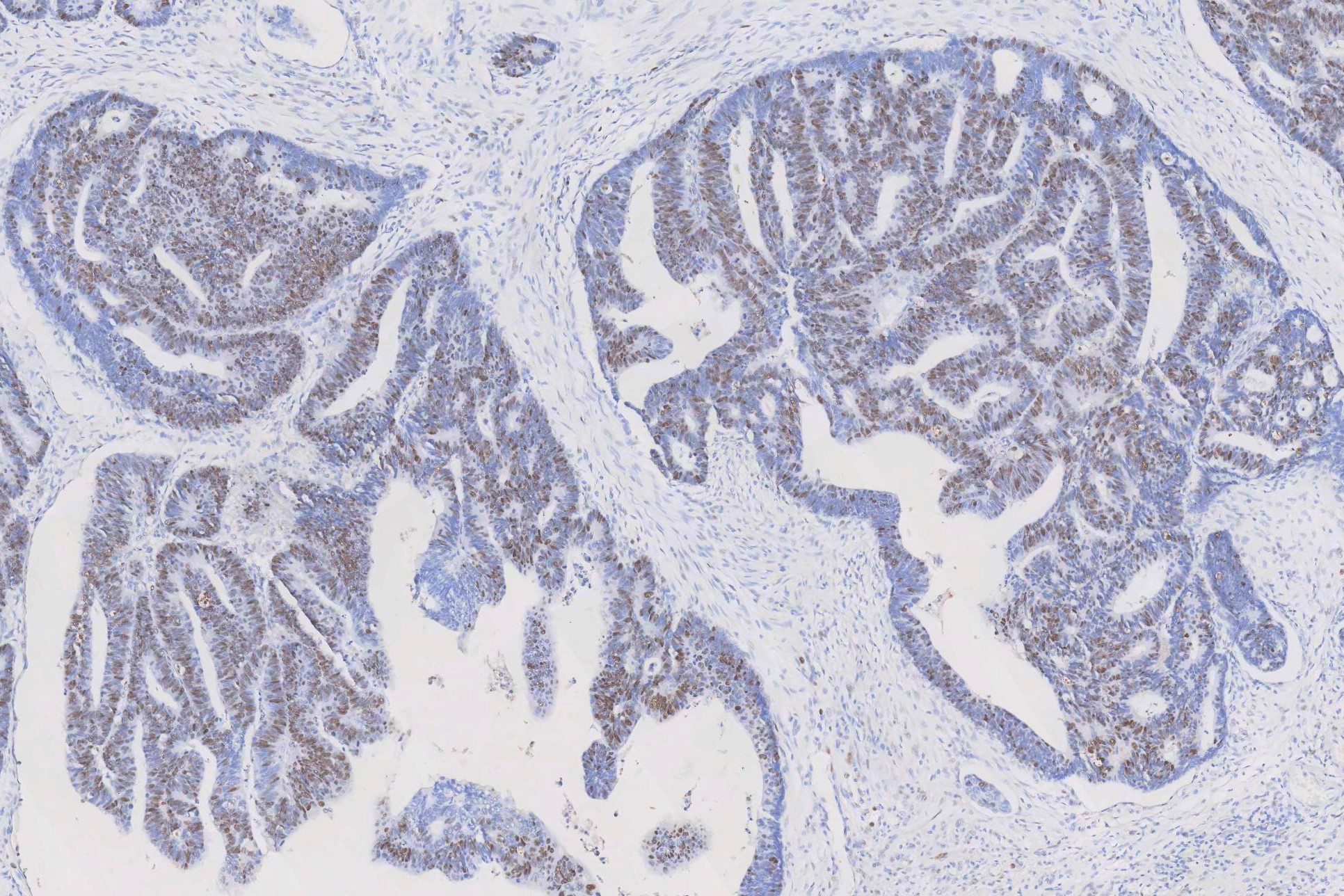 Antigen Retrieval 02